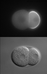 GFP:PAR-2