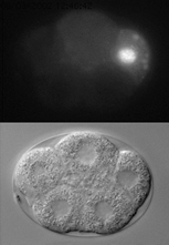 GFP:PIE-1